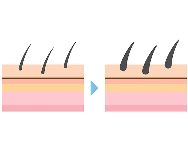 背中が剛毛になることを硬毛化と呼びます