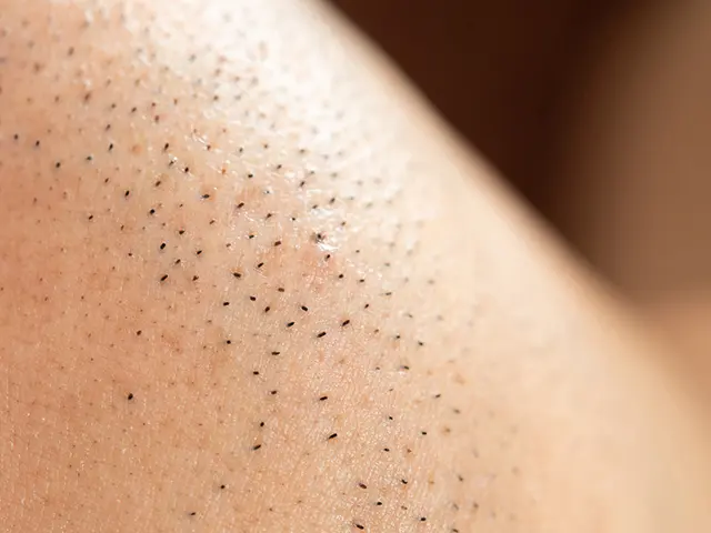 剛毛になった場合は注意点があります