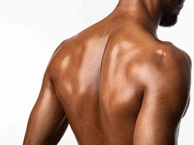 背中の脱毛によって美しい背中が手に入ります