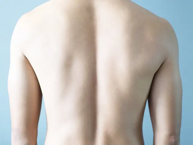 背中の脱毛がどのくらいの期間で完了するのかは個人差があります