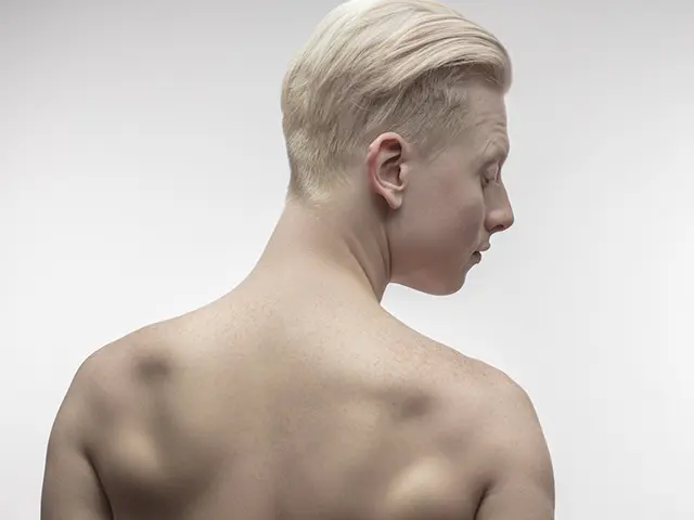 背中の脱毛範囲がどこまでなのかはサロンによって異なります