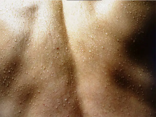 背中を脱毛して汗の量が増減することはありません