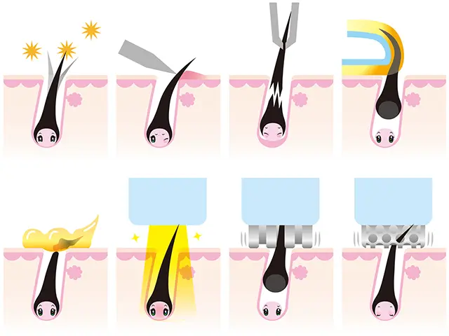 自己処理にはさまざまな方法があります